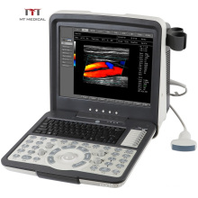 MT Medical High Specification Digital 3D/4D Color Doppler Veterinary Portable Ultrasound Scanner